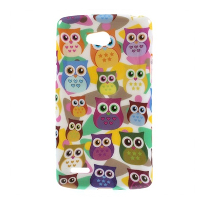 coque personnalisee LG L80